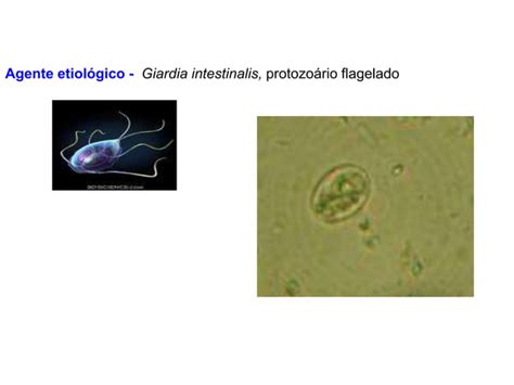 Parasitologia Giardia Lamblia Ppt