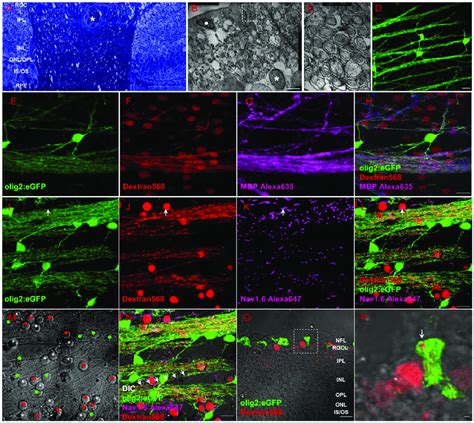 Oligodendrocytes Exist Within Retina Of Adult Zebrafish A Toluidin