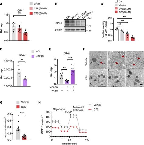 Jci Insight Lipogenesis Promotes Mitochondrial Fusion And Maintains