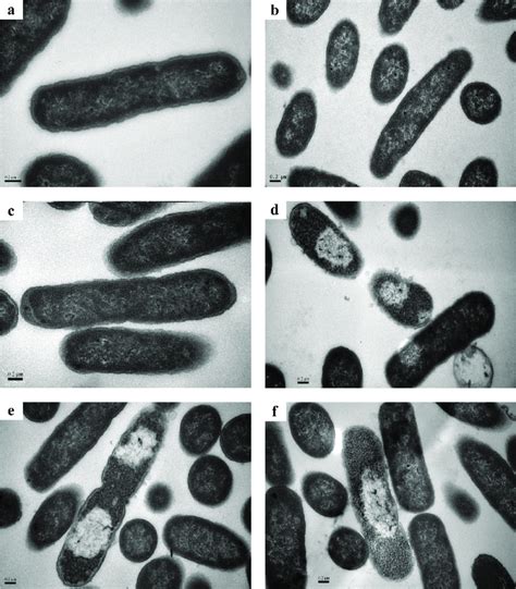 Transmission Electron Micrographs Tem Of Escherichia Coli Treated Download Scientific Diagram