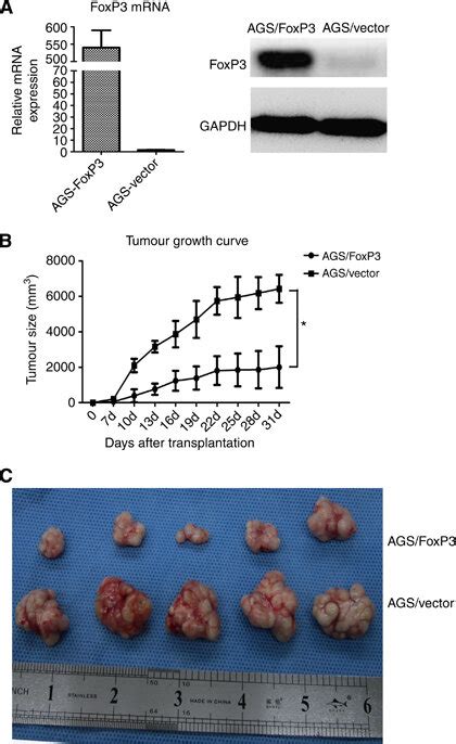 Foxp3 Upregulation Inhibits Gc Cell Growth In Vivo A Download