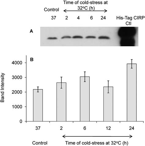 Cold Inducible Rna Binding Protein Cirp Expression Is Modulated By