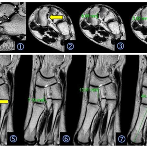 Graphic Interpretations 1 MRI Scanning Images Of The Sagittal