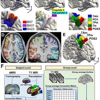 Neuroanatomy and parcellation of precuneus. (A) The territory of ...