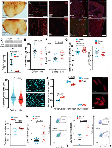 Disruption Of Cardiac Sympathetic Innervation Increases Postnatal