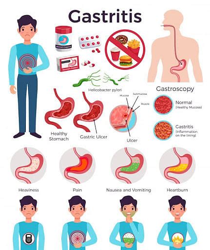 Gastric Meaning Causes Symptoms And Diagnosis