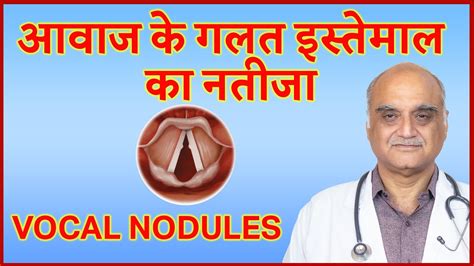 Vocal Cord Nodule Cause Of Hoarse Voice Hindi