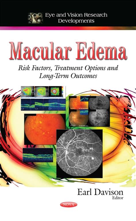 Types Of Macular Edema