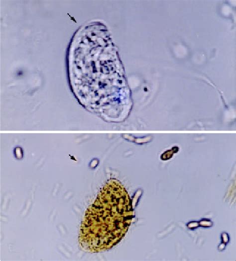 Balantidium Coli Trophozoites In Native A And Lugol B Preparations Download Scientific