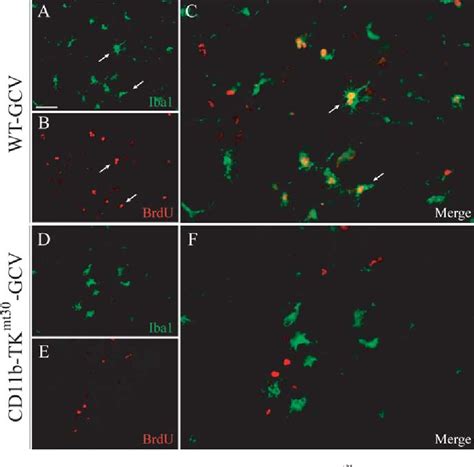 Pdf Selective Ablation Of Proliferating Microglial Cells Exacerbates