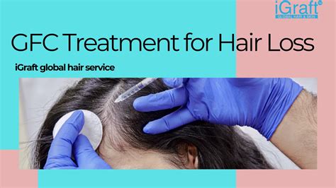 GFC Treatment For Hair Loss