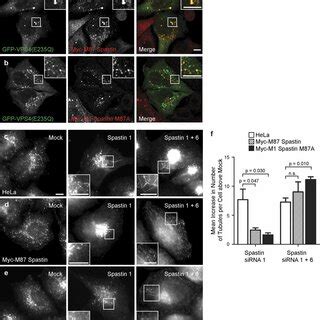 Spastin Regulates Endosomal Tubulation A And B HeLa Cells Were