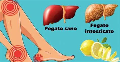 Fegato Che Sintomi Da Il Fegato Grasso