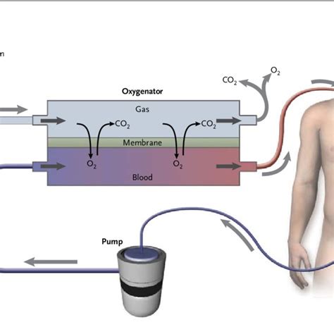 The Oxygenator In Venovenous Ecmo The Extracorporeal Membrane