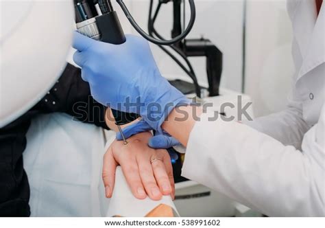 Removal Benign Tumors Cosmetic Salon Use Stock Photo 538991602 ...