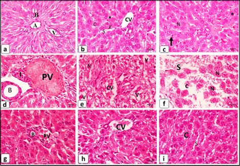 Photomicrographs Of Sections Of The Liver A C Photos Of Control Download Scientific Diagram