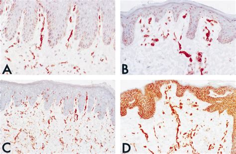 Light micrographs (low magnification) of pig skin grafts immunostained ...