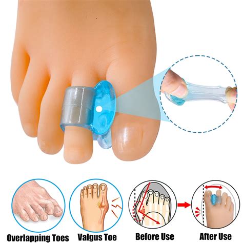 Separador De Dedos De Silicona Para Juanetes Corrector Para Pies