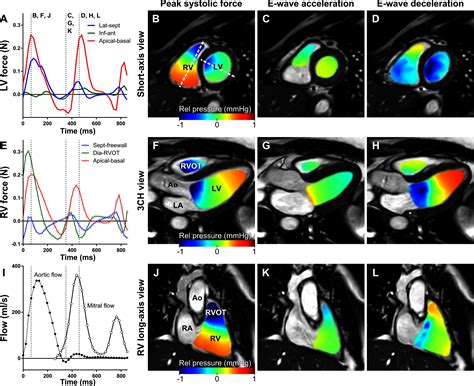 Left And Right Ventricular Hemodynamic Forces In Healthy Volunteers And