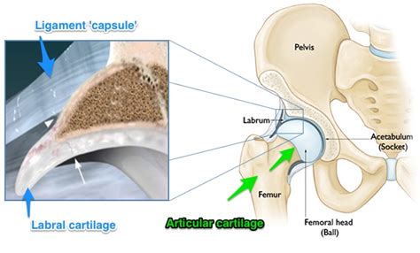 Hip Arthroscopy Doctor