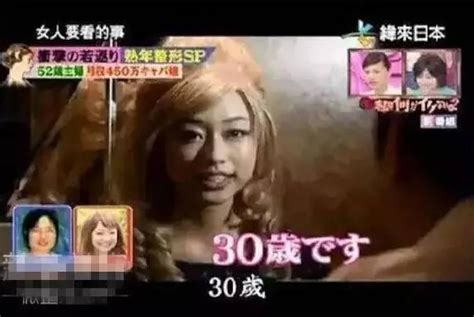 日本大媽花450萬日元整容！從52歲變成25歲少女 ！ 每日頭條