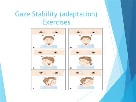 lect  vestibular rehabilitationpptx