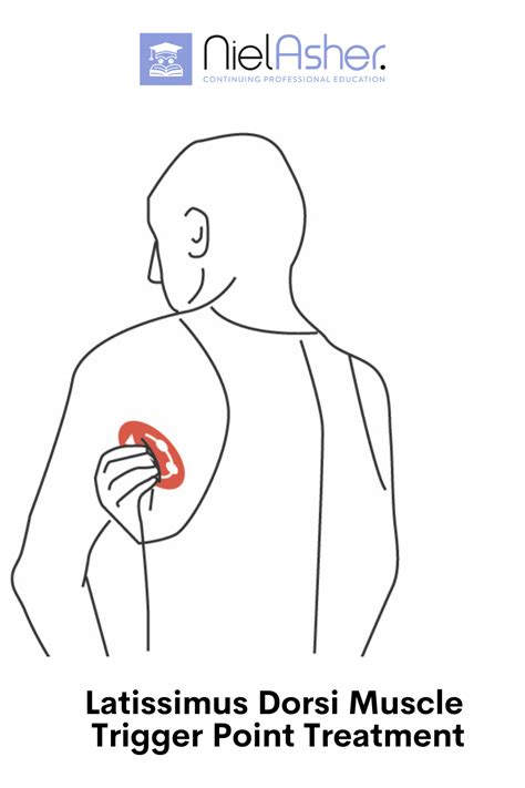 Latissimus Dorsi Muscle Self Help Trigger Point Treatment Artofit