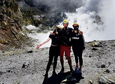 White Island Volcano Survivor Stephanie Browitt Removes Compression