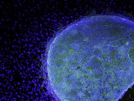 Reuters First Patients Shown To Improve With Embryonic Stem Cells