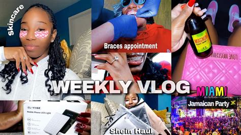 WEEKLY VLOG Come With Me To Get My Braces Tightened PAIN LEVEL