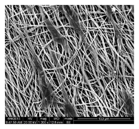 Comparison Of Random Electrospun Pcl Plga Material And Aligned