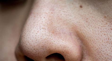 Elimina Los Puntos Negros De La Nariz Con Esta Sencilla Mascarilla Casera