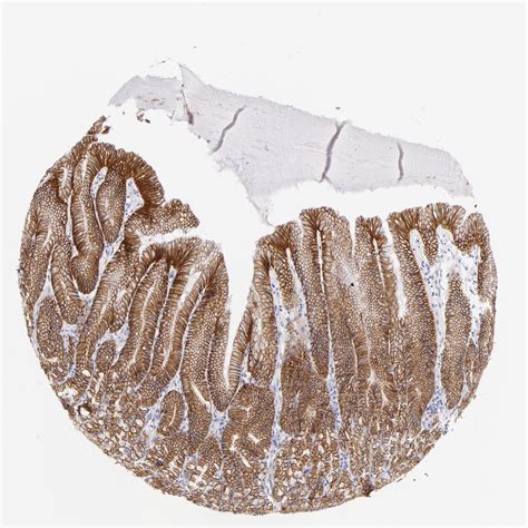 Tissue Expression Of Cdh Staining In Stomach The Human Protein Atlas