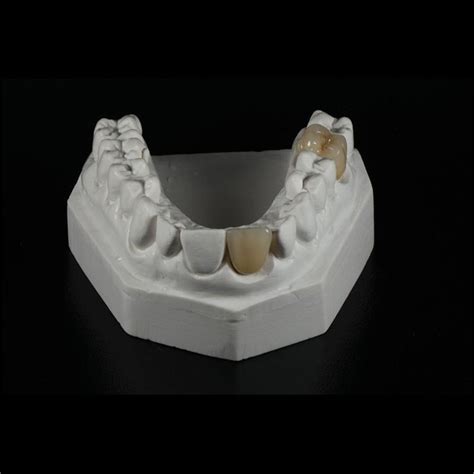 China Pfm Ceramic Crowns Manufacturers Suppliers Factory Low Price