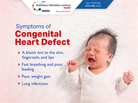 Symptoms Of Congenital Heart Defect