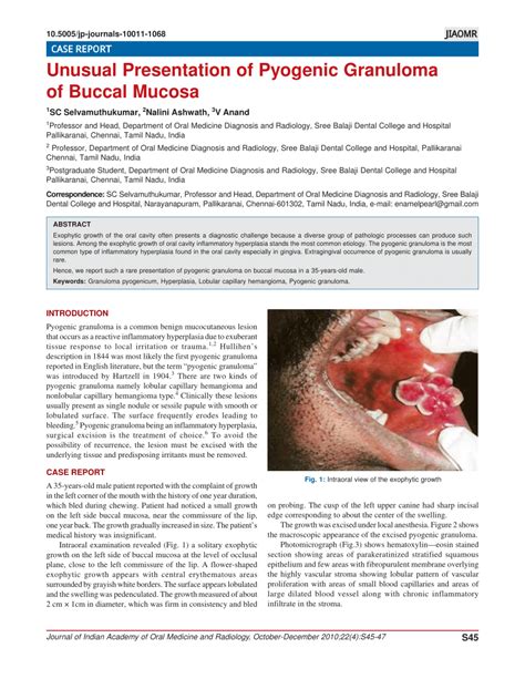 PDF Unusual Presentation Of Pyogenic Granuloma Of Buccal Mucosa