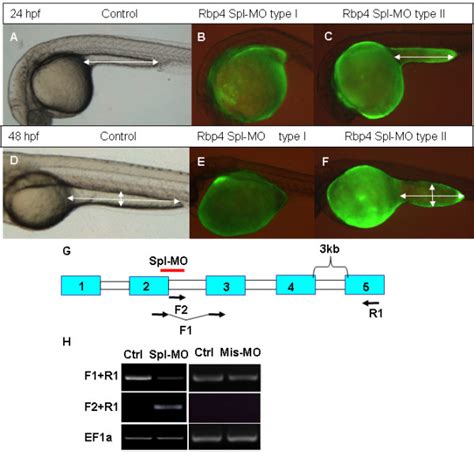 Effects Of Rbp4 Splicing Mo On Morphology Of Embryos Rbp4 Spl Mo Was