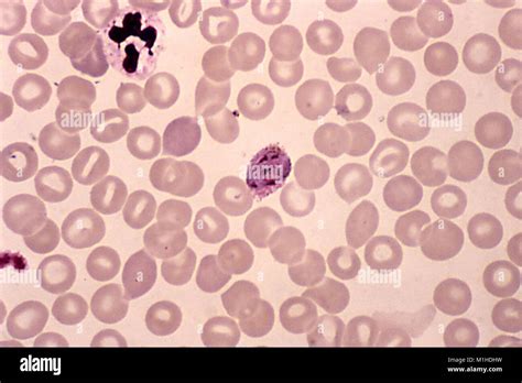 Microfotografía De Un Giemsa Schizont Teñidos De Plasmodium Vivax Un Parásito Que Causa La