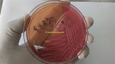 Lactose Fermenter (LF) and Non-Lactose Fermenter (NLF) Gram-Negative ...