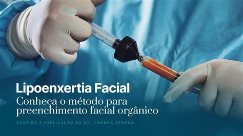 Lipoenxertia facial conheça o método para preenchimento facial