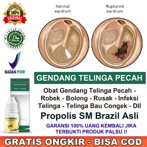 Jual Obat Gendang Telinga Pecah Robek Bolong Infeksi Telinga Bernanah