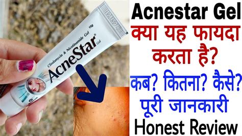 Acnestar Gel Review Acnestar Gel Kaise Use Kare Acnestar Gel Ke