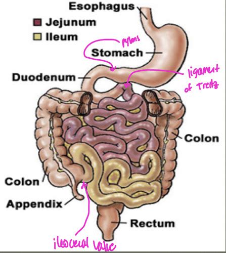 Dx Of Small Bowel Flashcards Quizlet