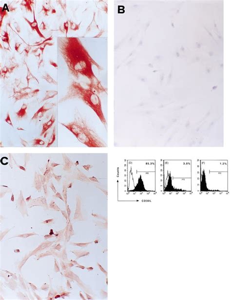 Cd30l Expression In A Cultured Tec Clone Derived From Postnatal Human