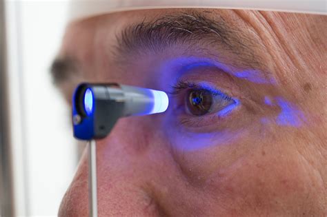 Cirurgia A Laser Transforma Olhos Castanhos Em Azuis Em Poucos Segundos