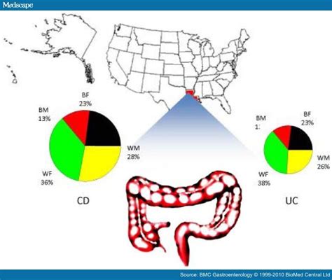 African American Inflammatory Bowel Disease In A Us Health Center