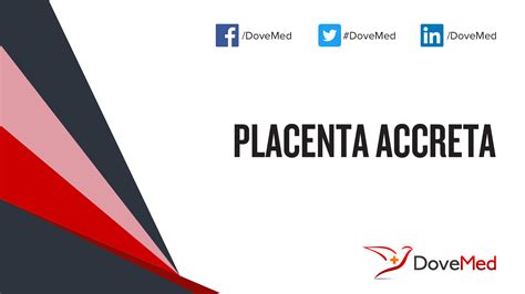 Placenta Accreta