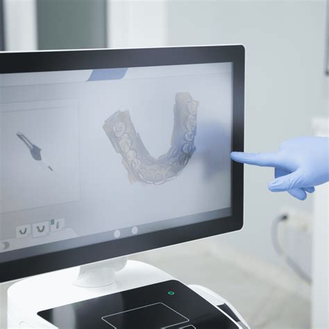 Intraoral Scanning In Dentistry