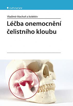 Ebook Léčba onemocnění čelistního kloubu v PDF ePub Mobi autor