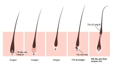 6 cách làm tóc mọc nhanh và khỏe Mẹo mọc tóc Mẹo chăm sóc tóc Tóc